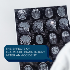 The Effects of Traumatic Brain Injury After an Accident